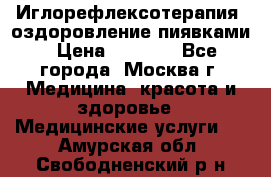 Иглорефлексотерапия, оздоровление пиявками › Цена ­ 3 000 - Все города, Москва г. Медицина, красота и здоровье » Медицинские услуги   . Амурская обл.,Свободненский р-н